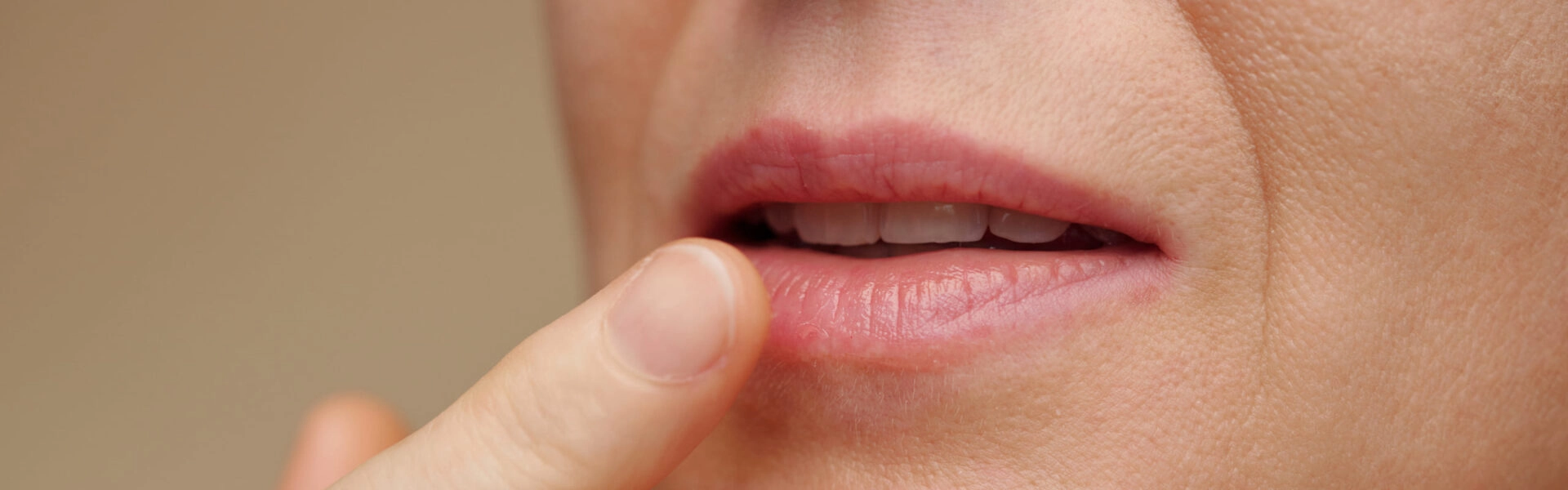 Cracked lips: causes, prevention and solutions to soothe and repair