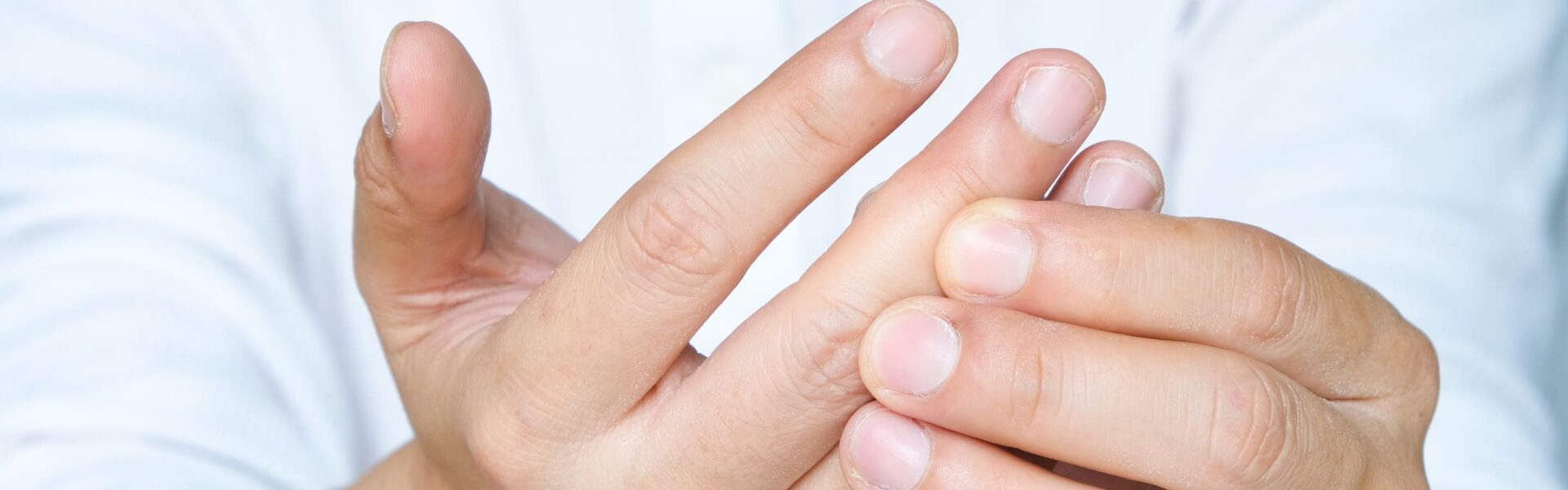 How to react in case of a superficial burn on the finger?