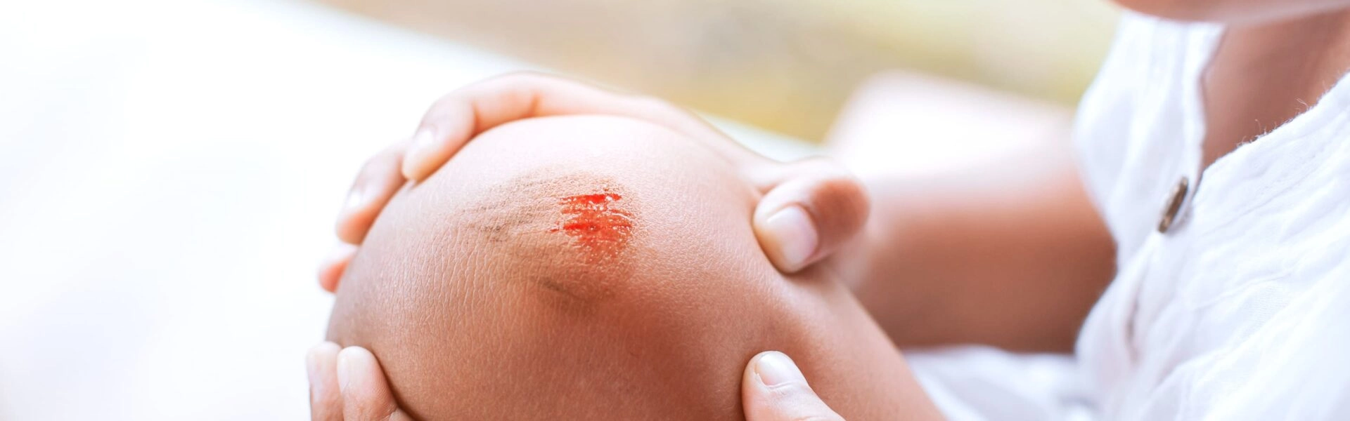 What should you do in case of minor burns and superficial wounds?