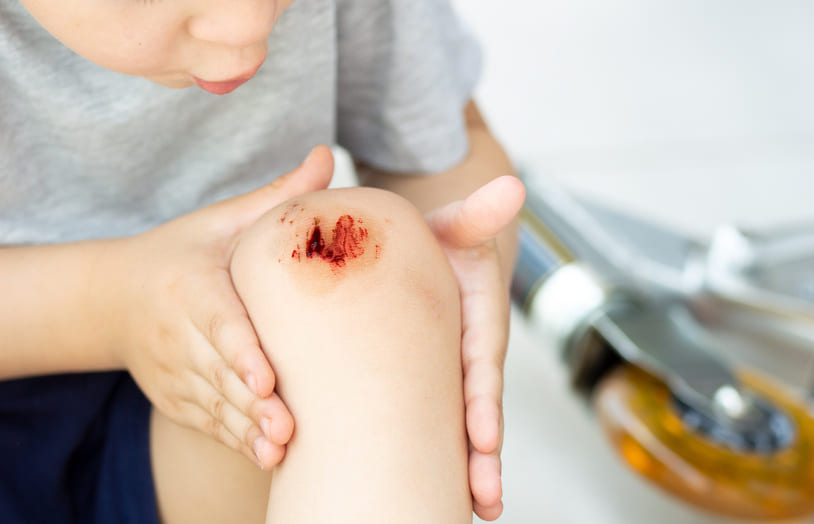 Our tips to promote wound healing